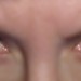 augen